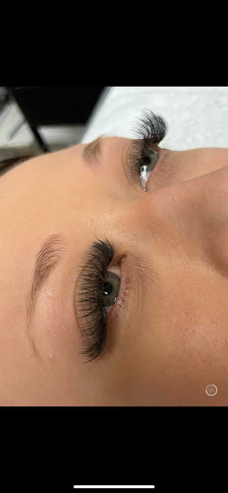3-4 Week Volume Fill