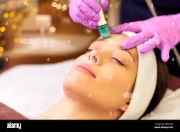 Microdermabrasion