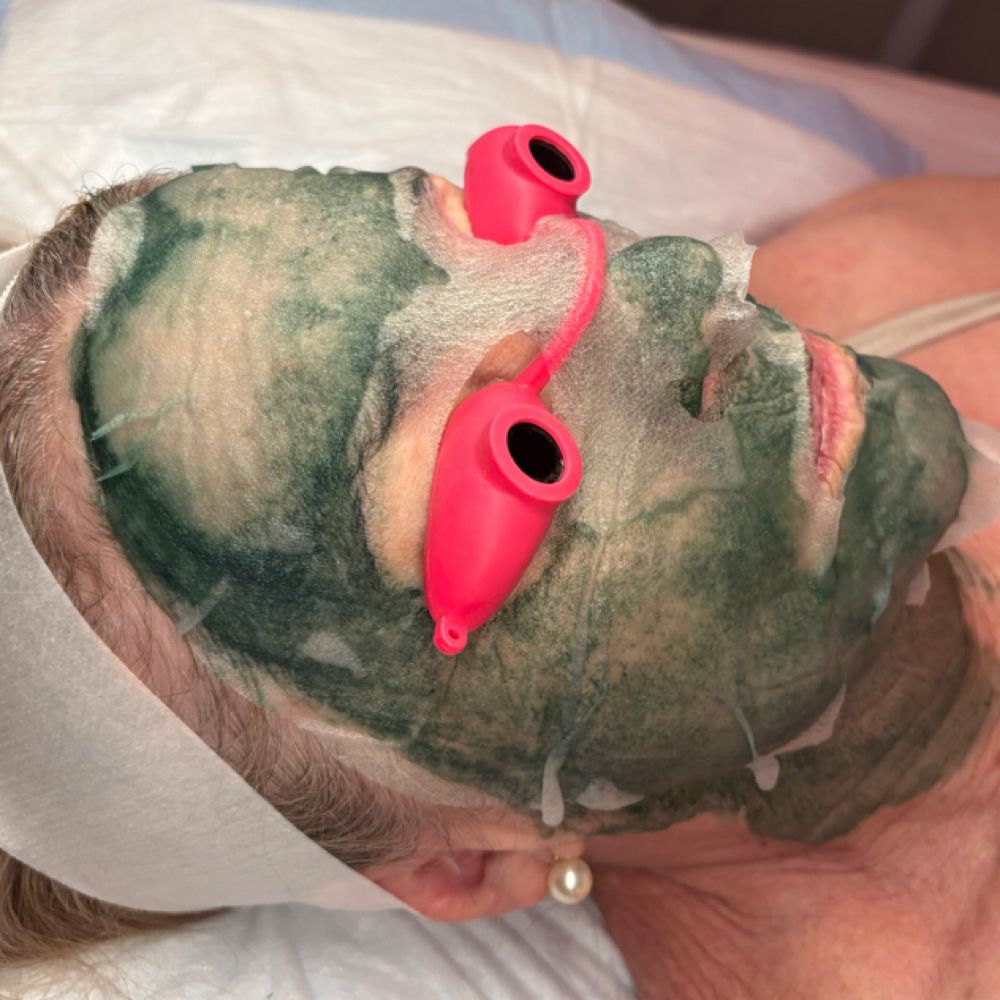 Liquid Microneedling Peel at Euphoria Skin in Chandler, AZ