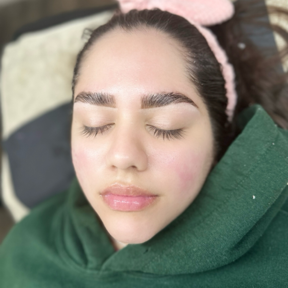 The Brow Lift — Lamination at Captivating Esthetics in Homestead, FL