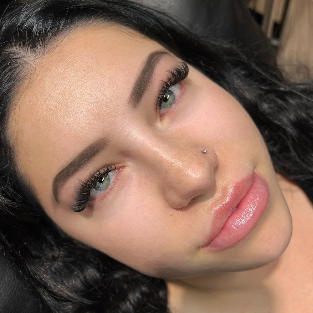 Light Volume Fill (2-3 weeks)