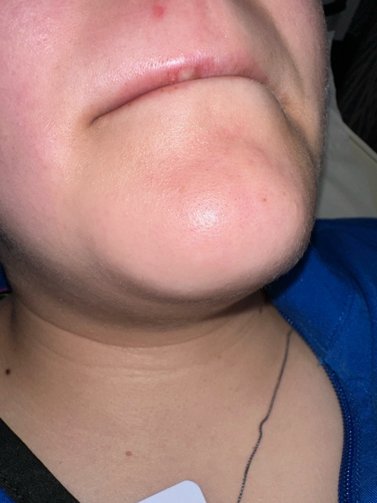 Chin Wax
