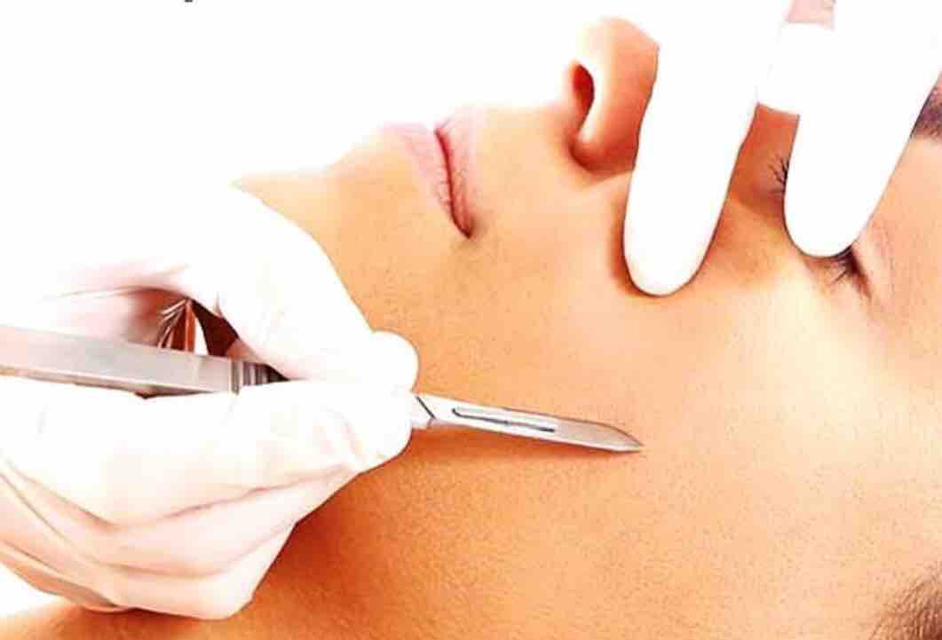 Dermaplane Facial