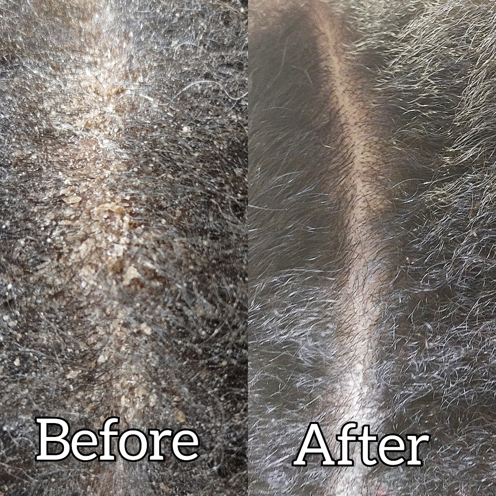 Customized Scalp Detox(Add On)