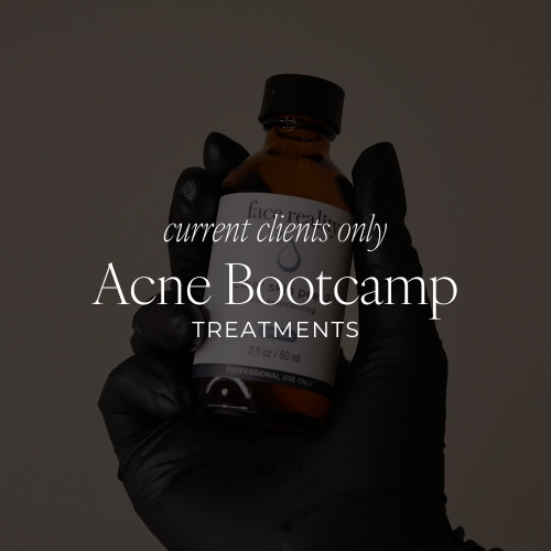 Acne Bootcamp Treatment