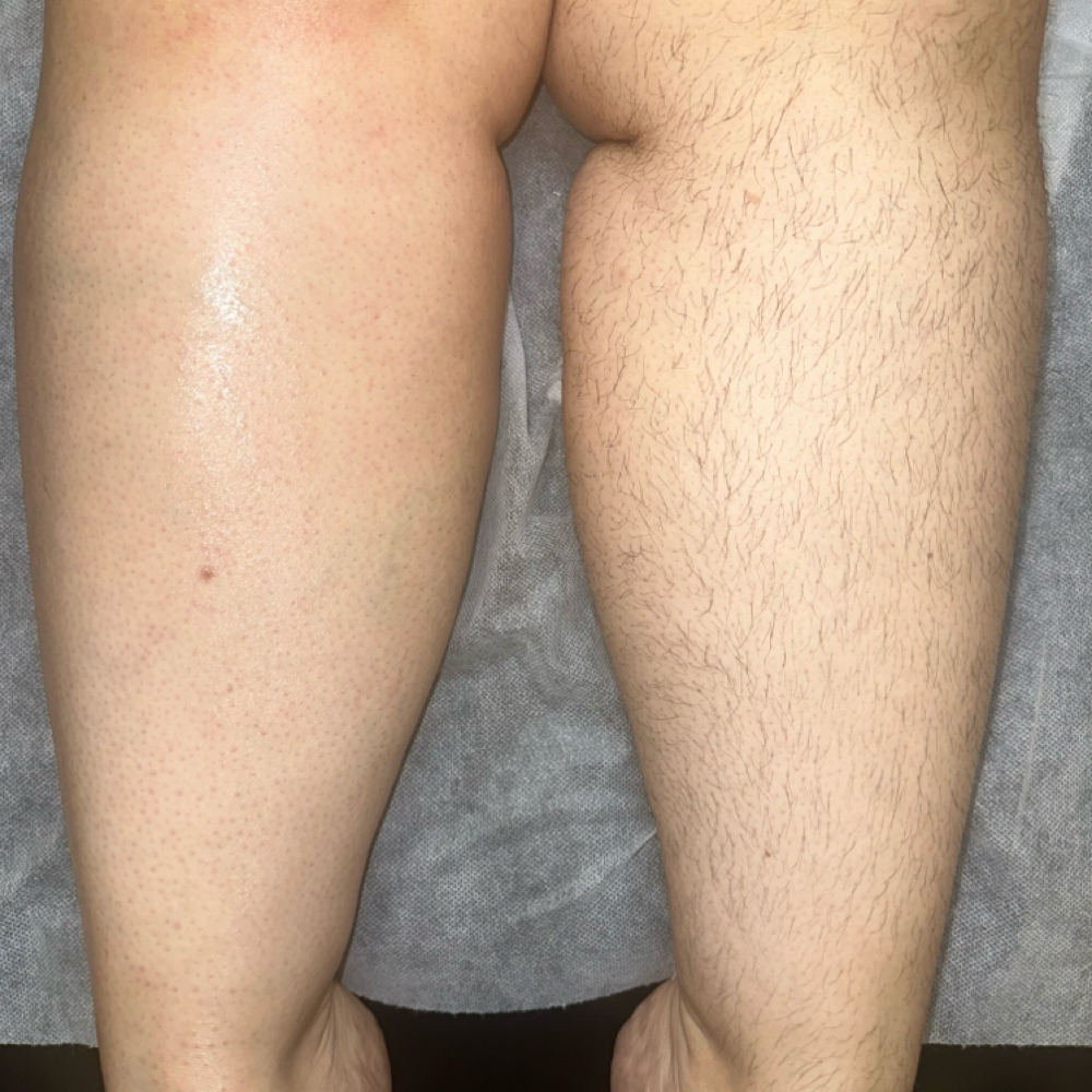 Full Legs at The Landing Strip Wax Studio LLC in Championsgate, FL