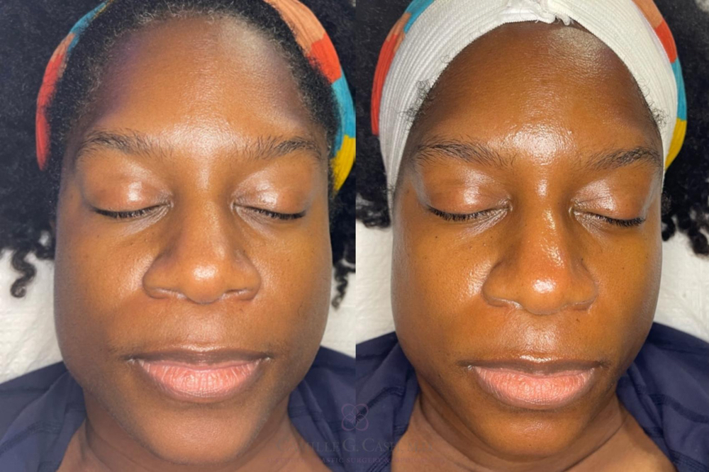 Glow-Up Facial