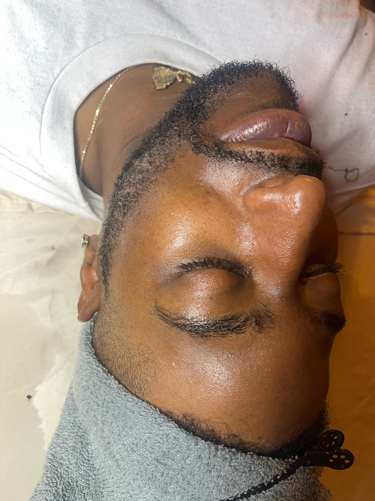 Ingrown Hair Removal Facial