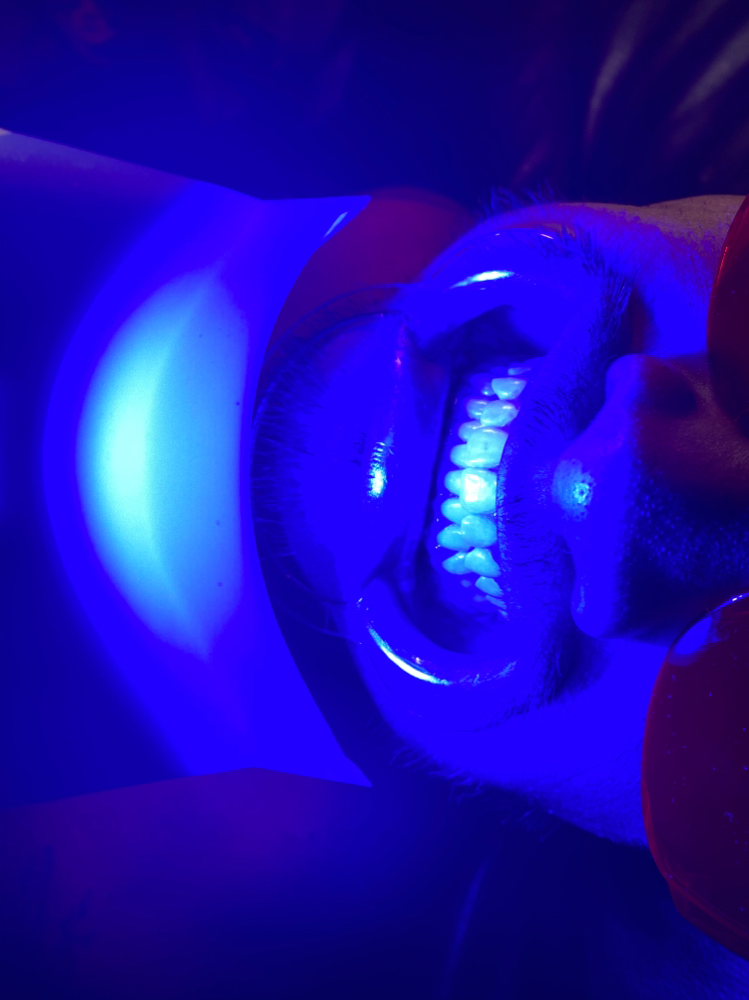 Teeth Whitening (30mins)