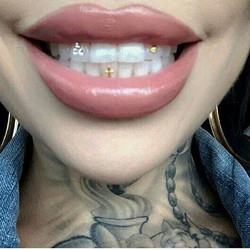 Tooth Gems