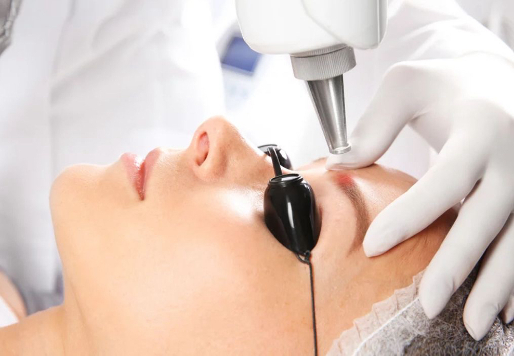 eyebrow permanent removal