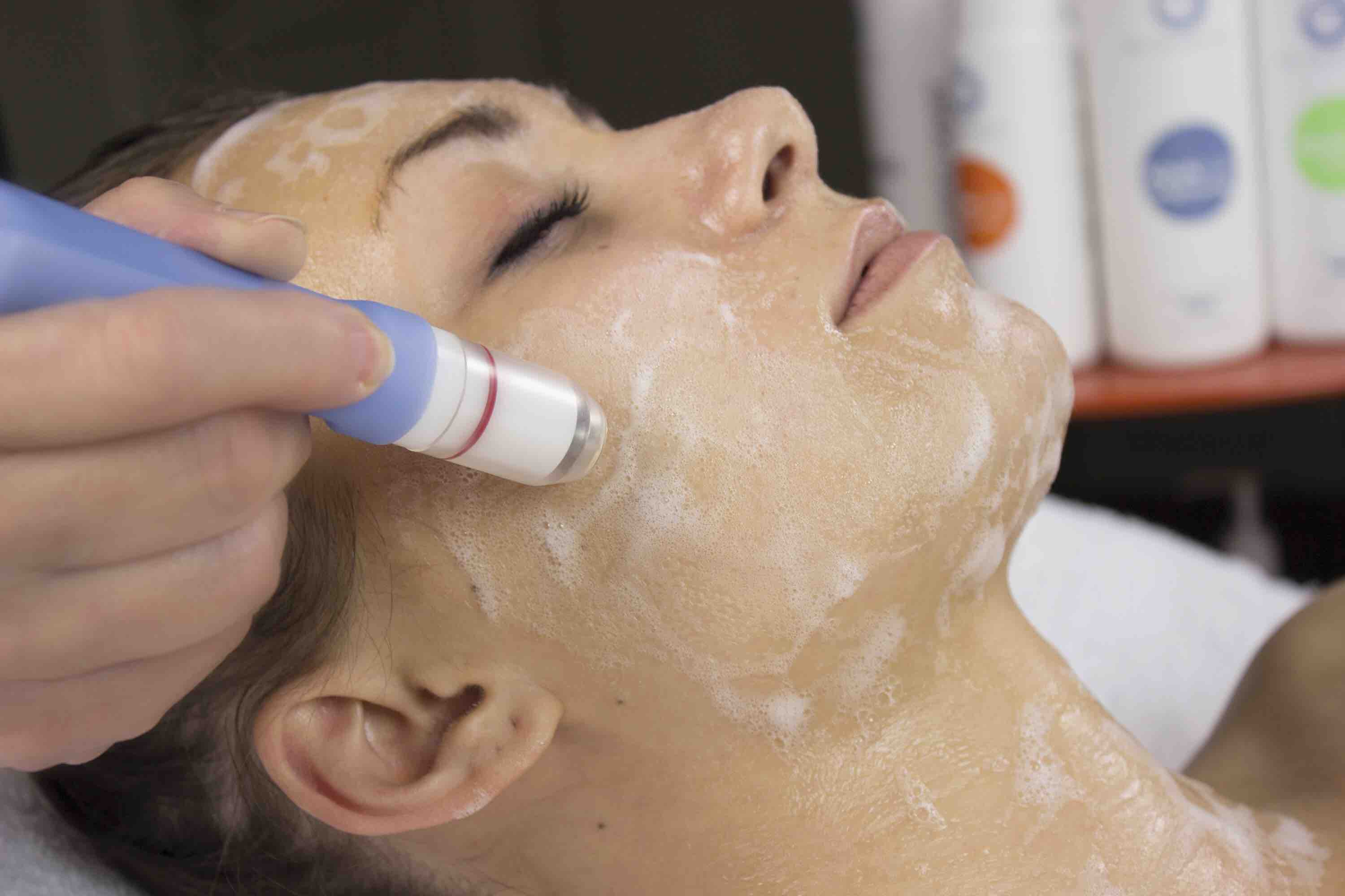 Hydrodermabrasion Facial