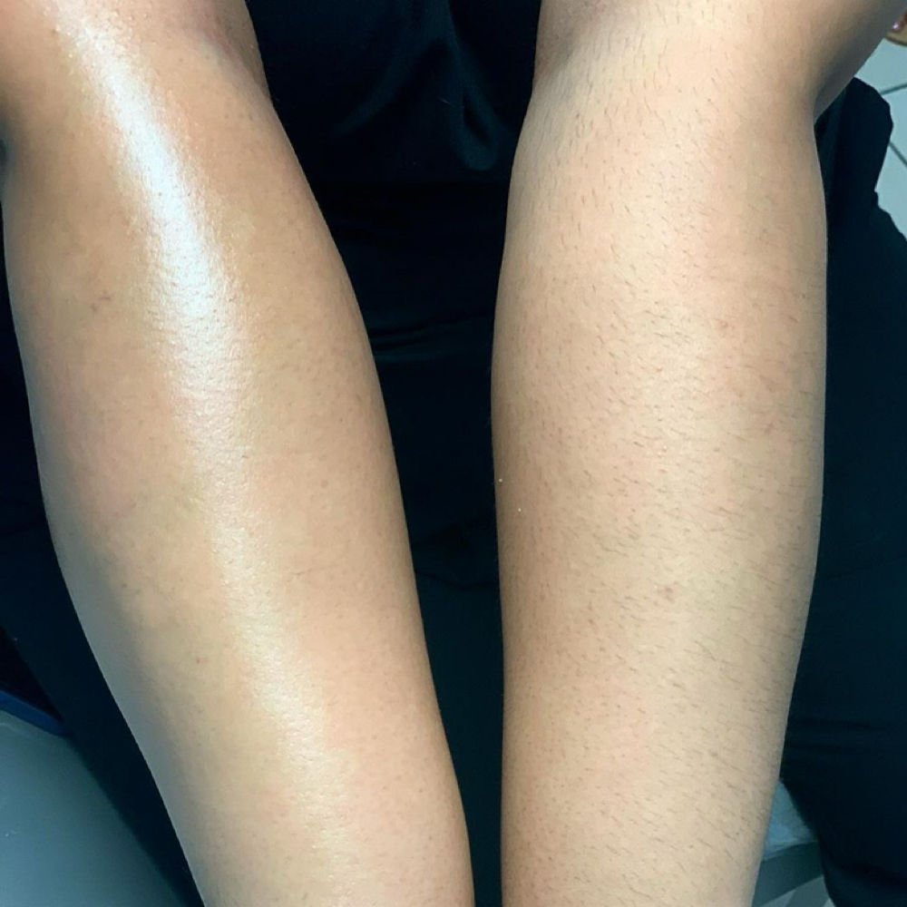 Full Arm Wax at Skin by Gia in Pueblo, CO