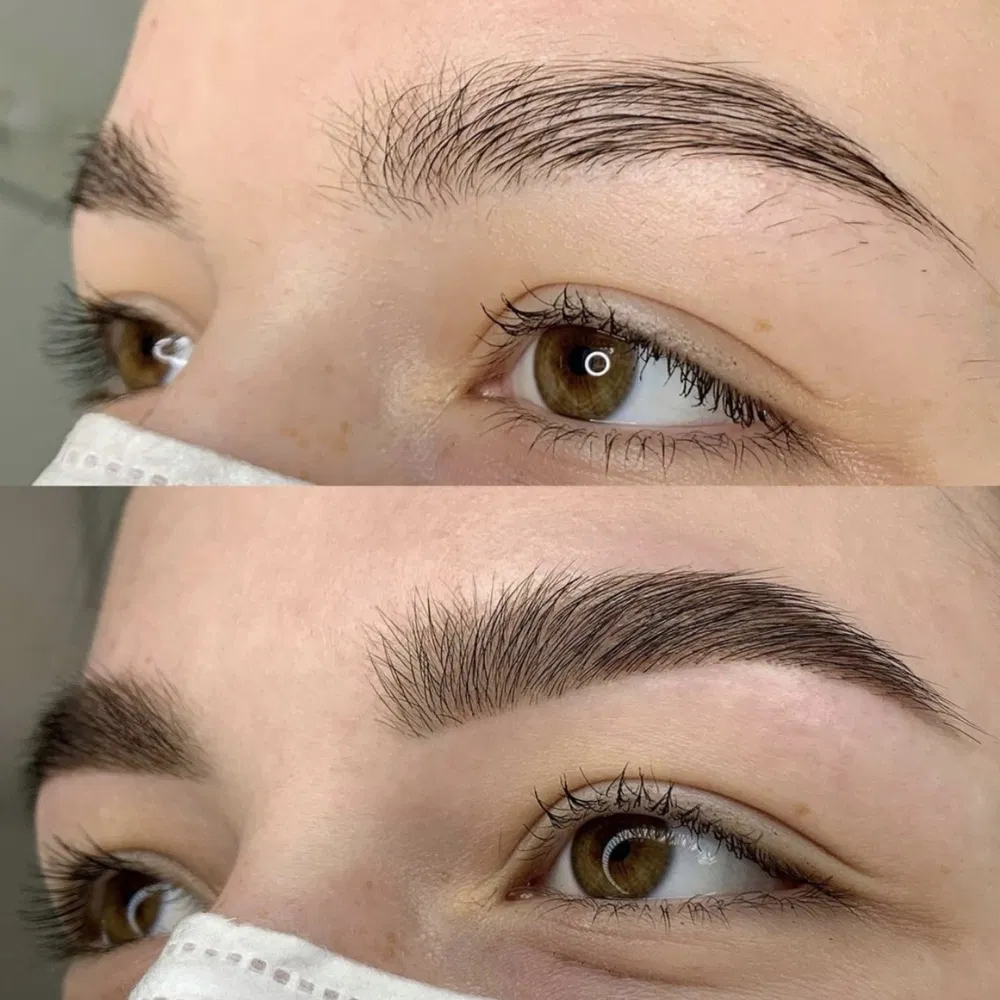 Brow shaping