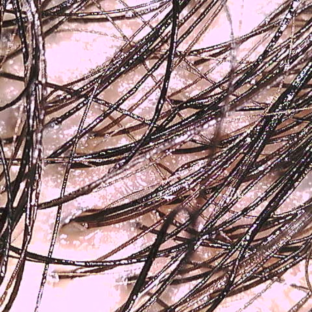 Trichoscopy (Scalp Image/TreatPlan at Lovingyournaturalself in Bakersfield, CA