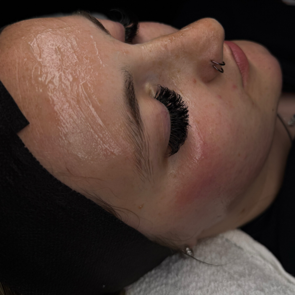 Express Dermaplane Facial at Indy blinx in Indianapolis, IN