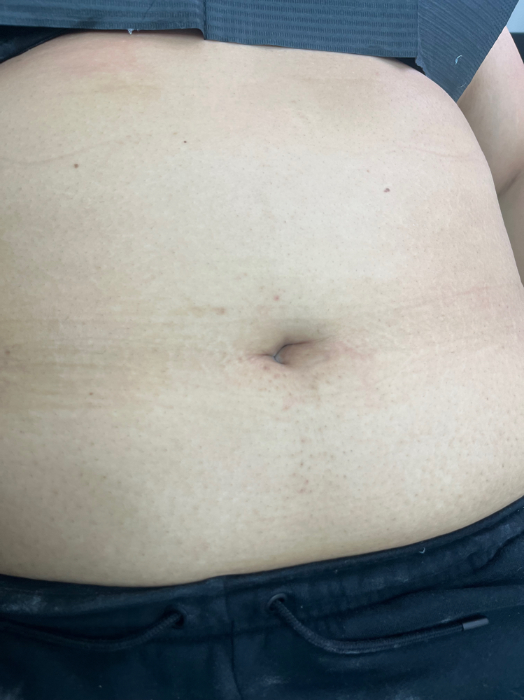 Stomach Wax