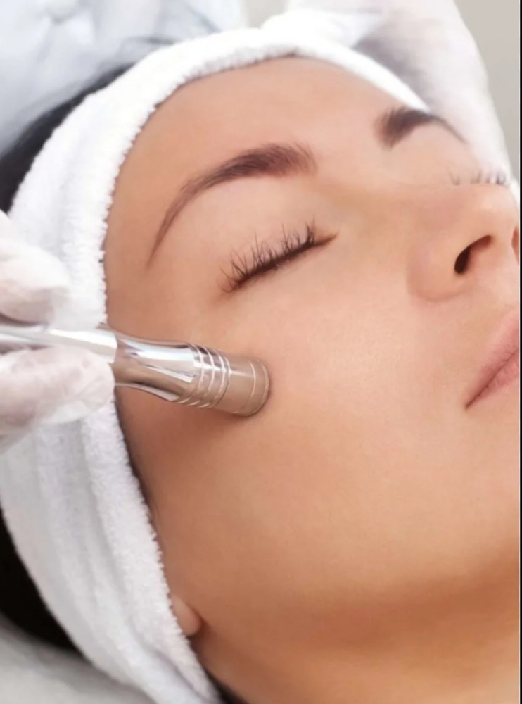 Microdermabrasion