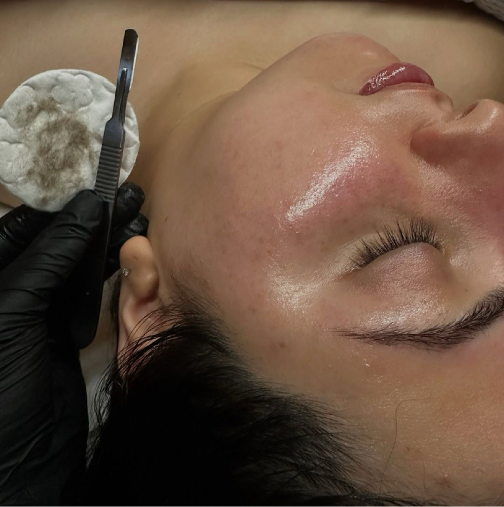 The Smooth Edit (Dermaplane Facial)