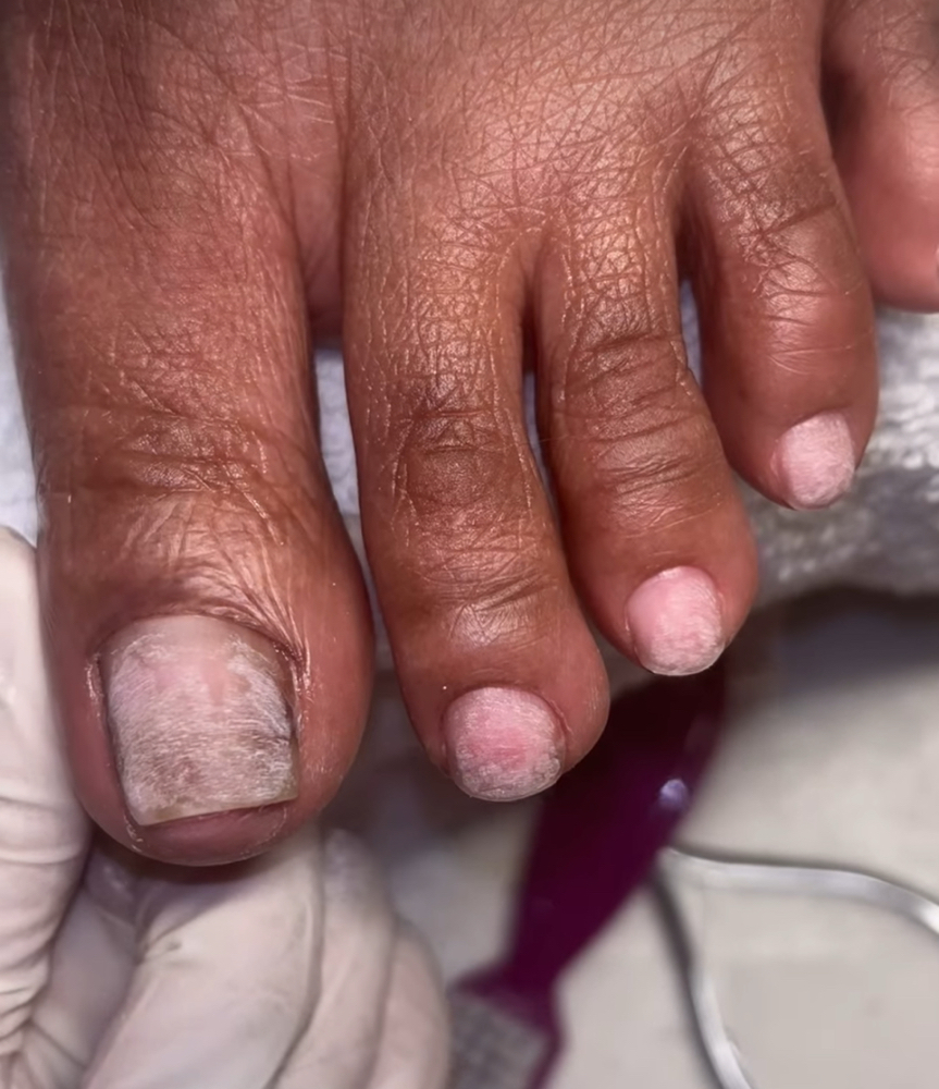 Dry Pedicure