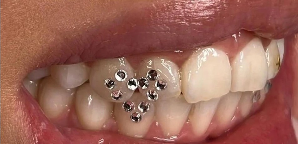 Swarovski Tooth Gem