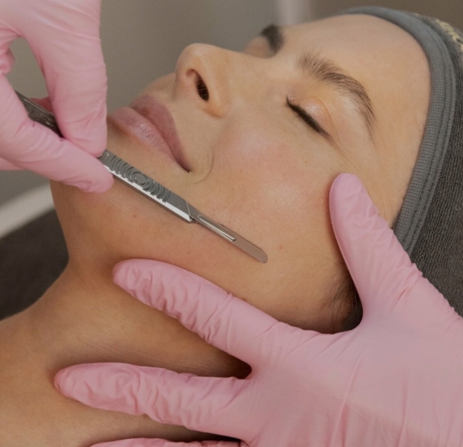 Dermaplaning