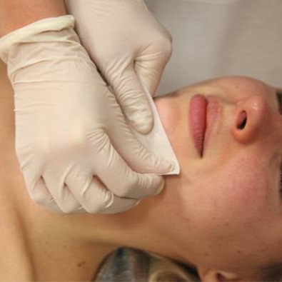Chin Wax at Beyond Aesthetics in Westport, MA