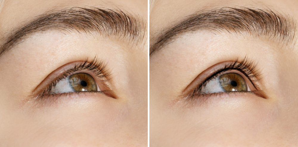 Eyeliner Enchancement