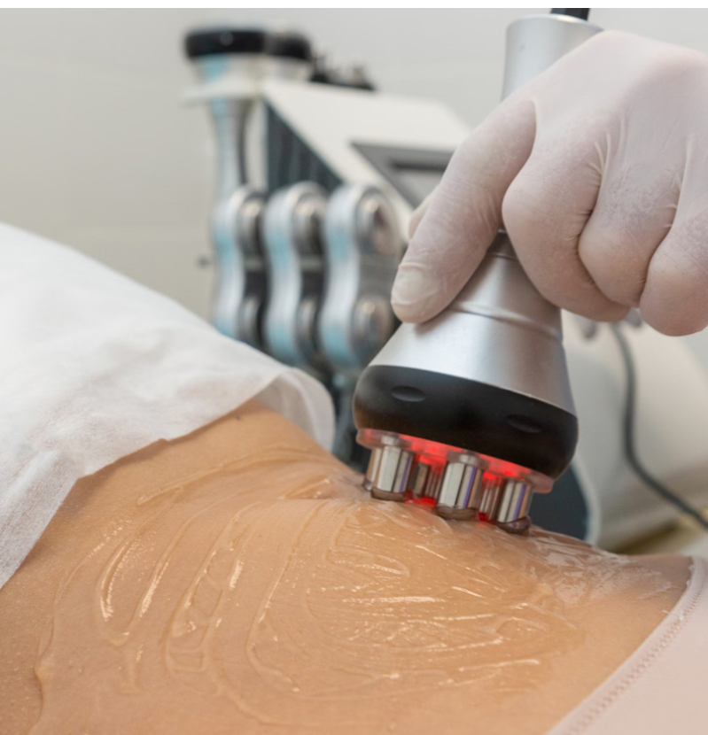 Body Firming Radiofrequency