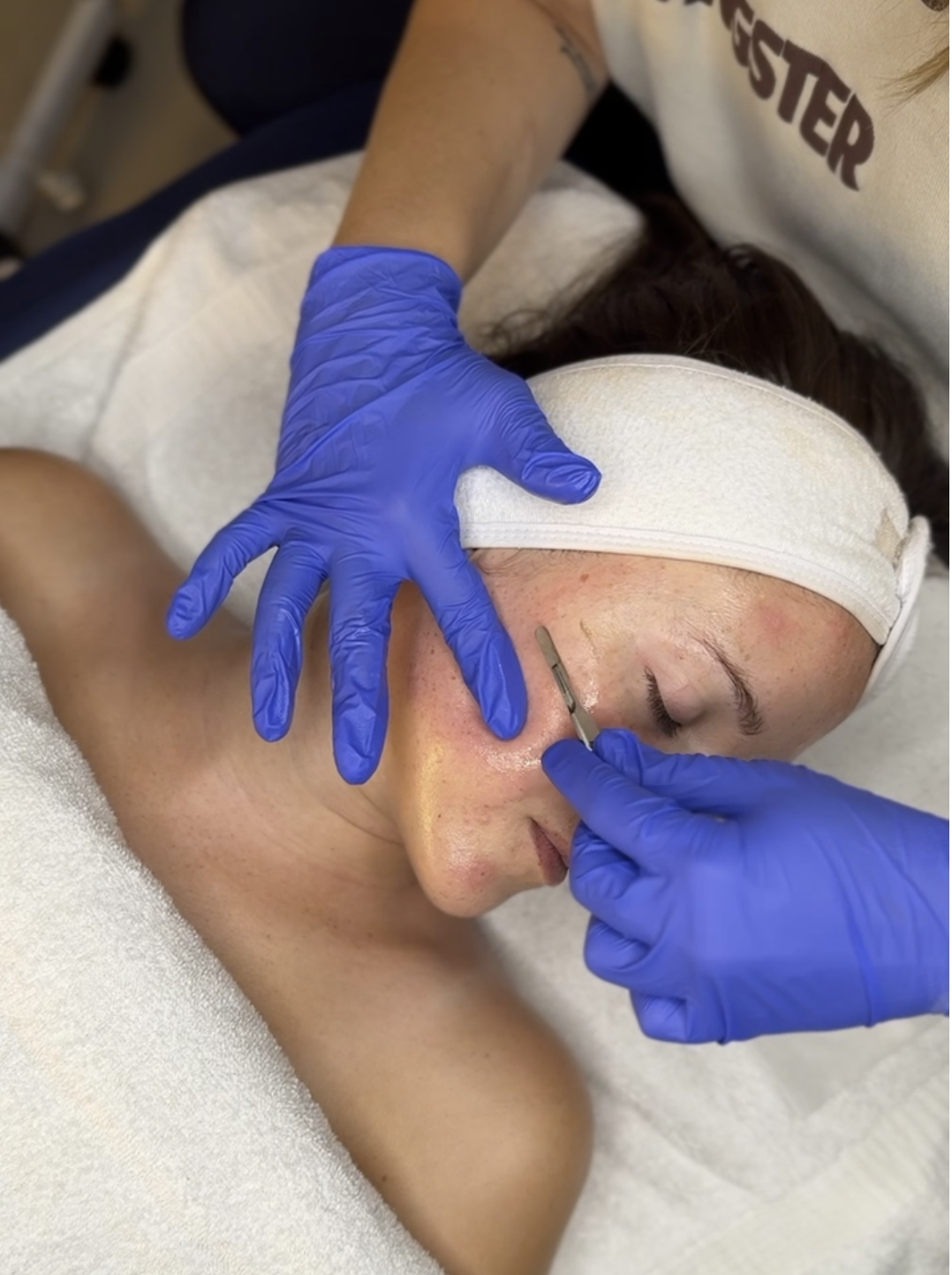 Dermaplane Facial