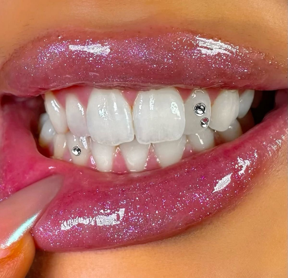 Tooth Gems
