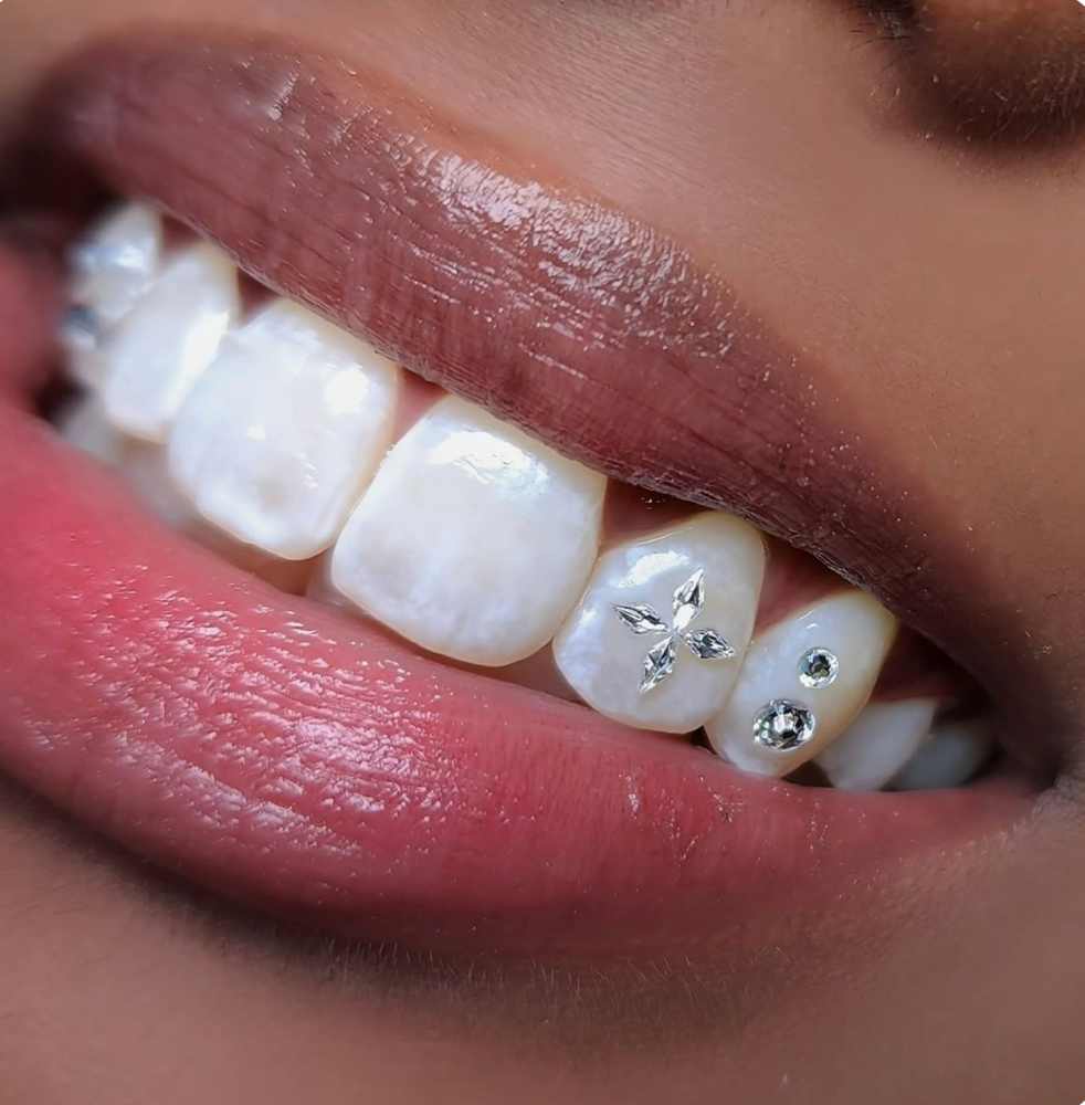 Tooth Gems