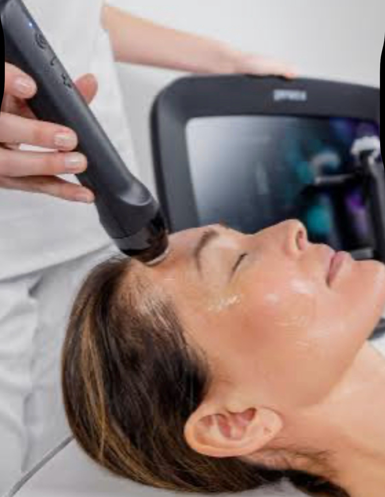 Ultrasound infusion Face Only