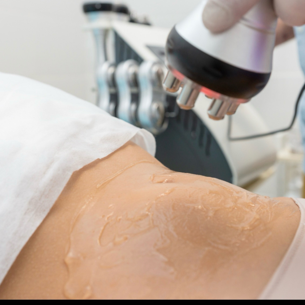 New Cliet Promo Cavitation at True Beauty Esthetics LLC in Palmview, TX