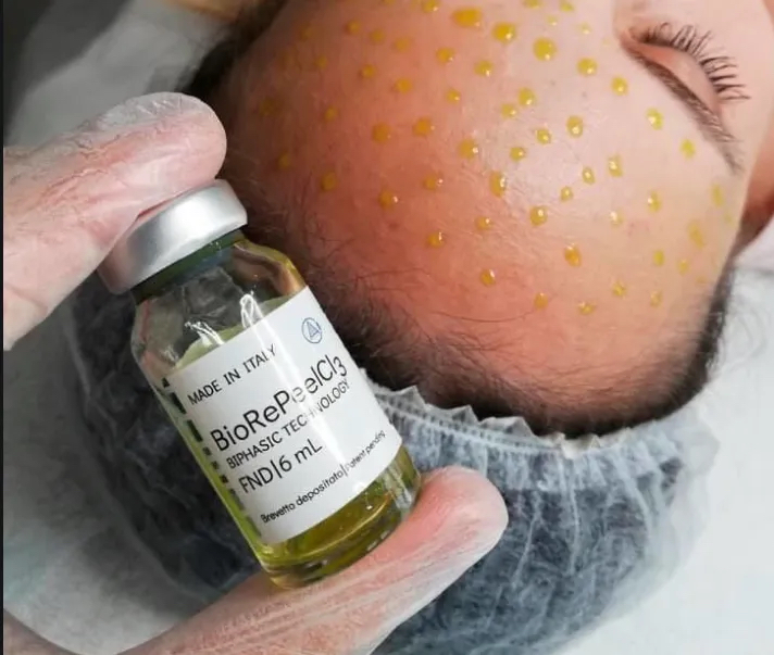 BioRepeel Facial