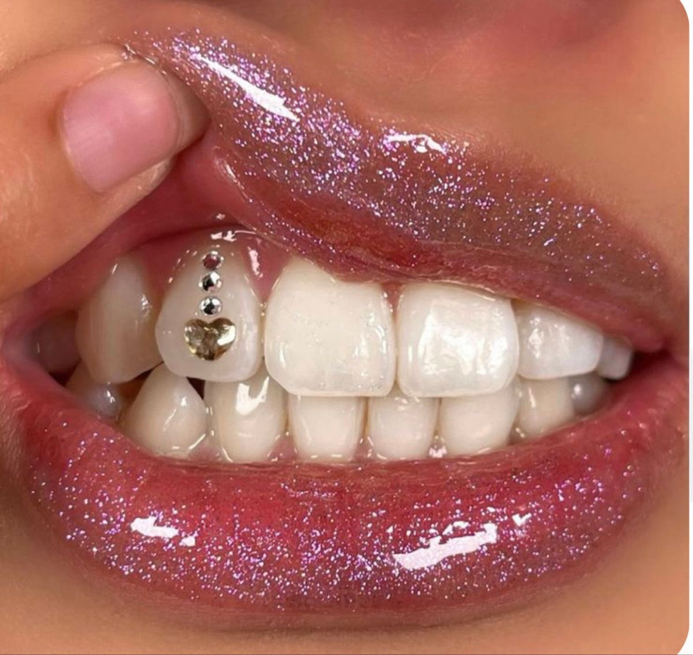 TOOTH GEM TRIM