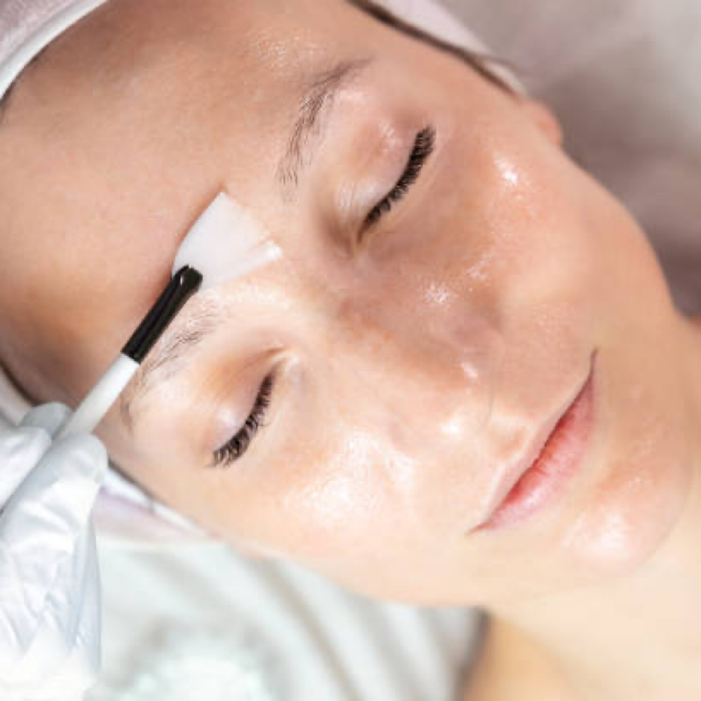 Customized Chemical Peel at Dermalove Aesthetics in Portland, OR