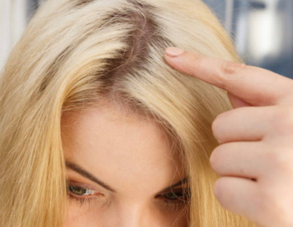 Root Touch Up