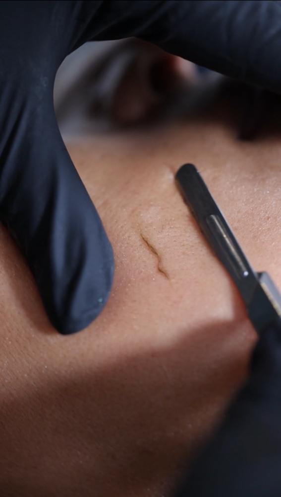 Luxe Dermaplaning Treatment