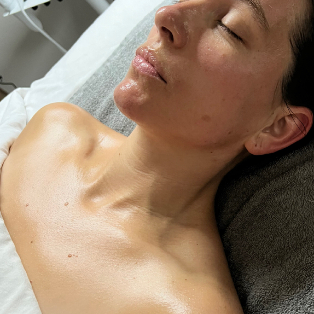 Decollete Chemical Exfoliant/Peel at The Skin Co. in Orange, CA