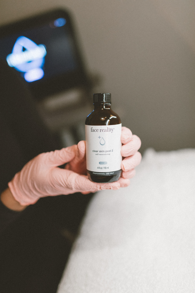 Acne Peel at Golden Skin Bar in Mesa, AZ