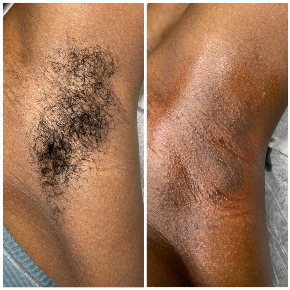 Underarms at Desirable Clawz Nail & Feet Boutique in Hampton, GA