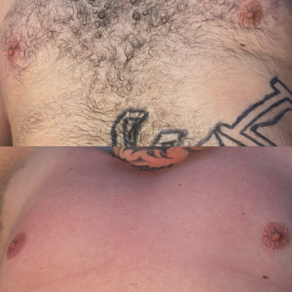 Chest at Charismatic Beauty in Apple Valley, CA
