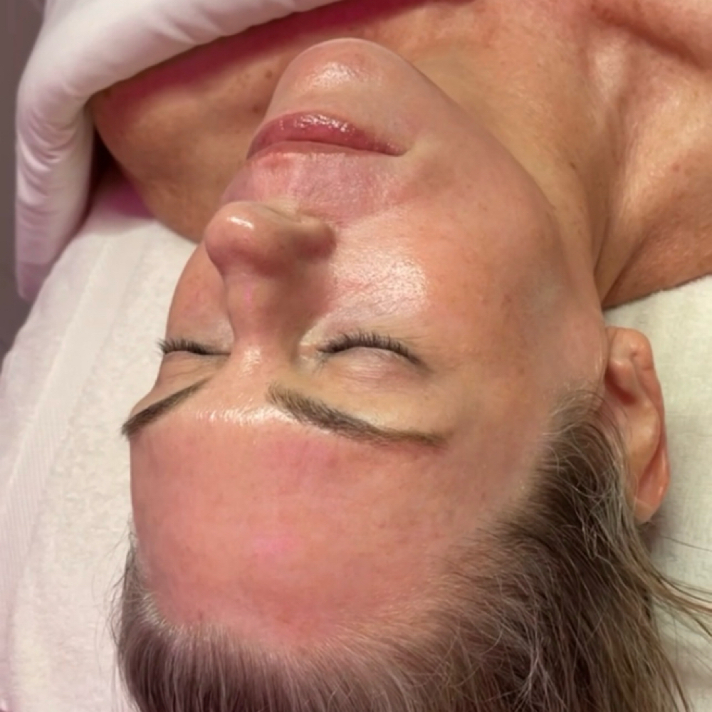 Let’s Peel! Facial at Divine Skin Esthetics in San Diego, CA