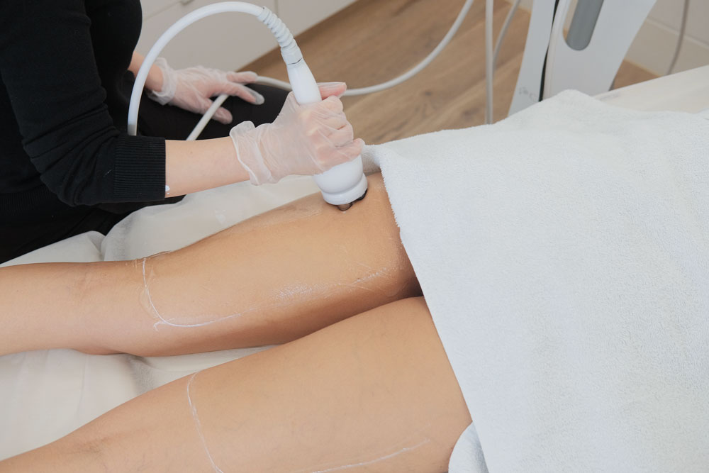 6 Of The Cellulite Reduction