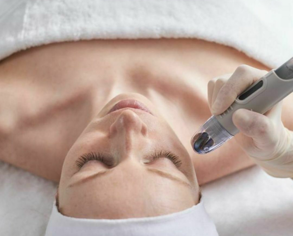 DermaFrac Microchanneling Infusion