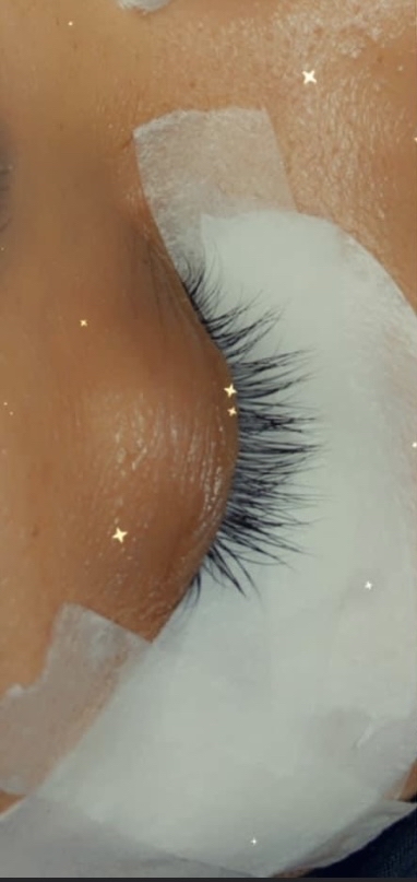 Eyelash Removal