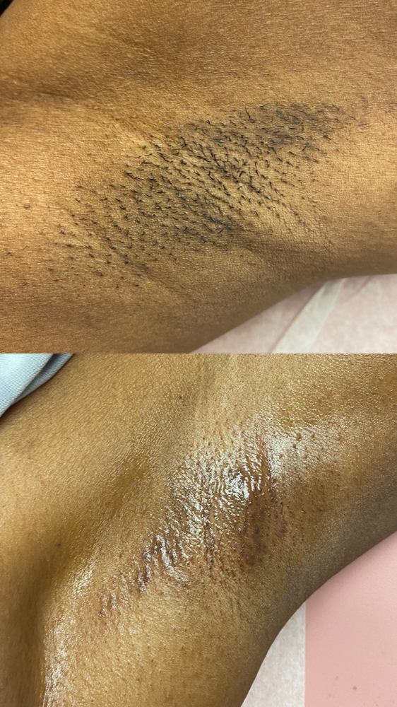 Under Arm Wax