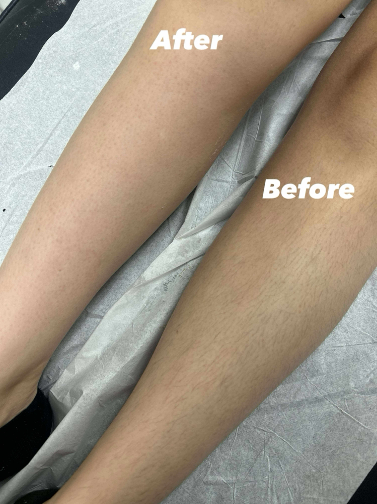 Full leg wax