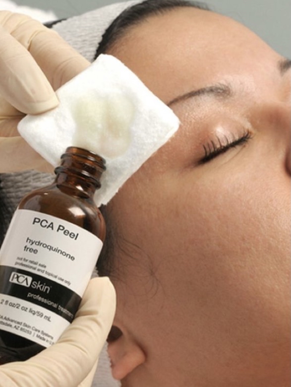 Chemical Exfoliation